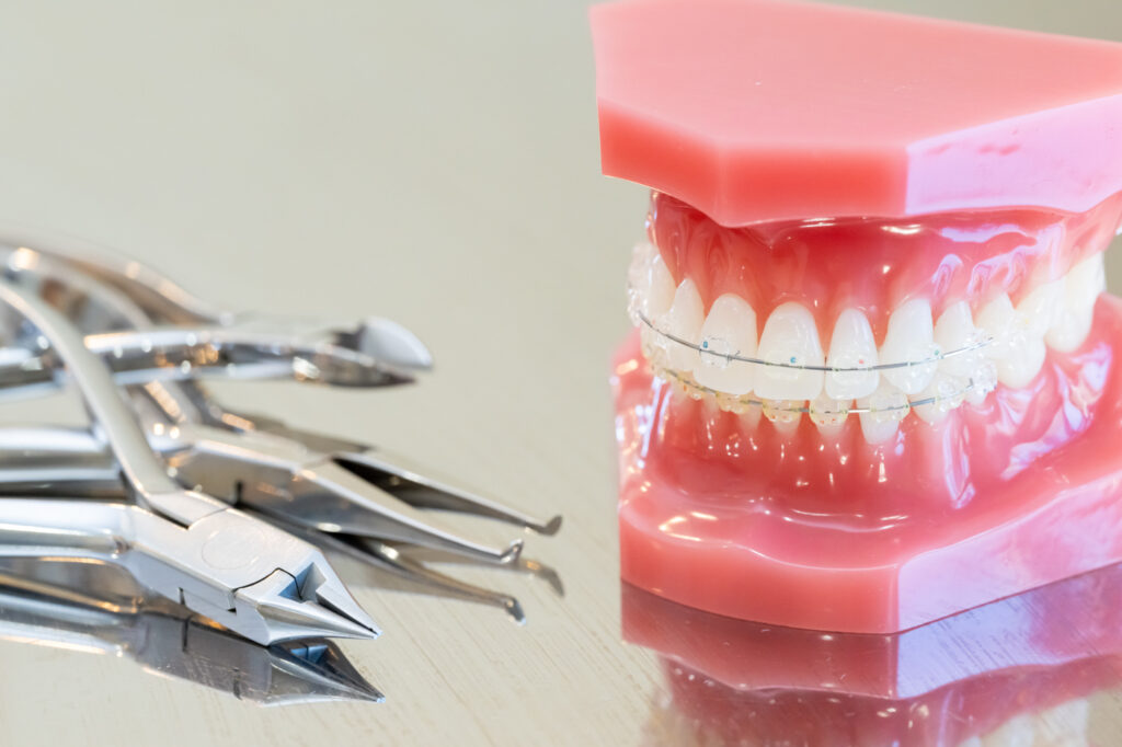矯正歯科イメージ